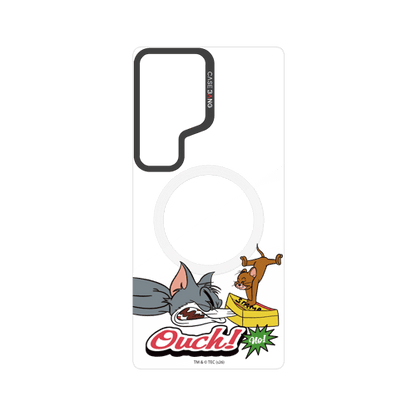 Ouch Box Trick Snap-On Phone Case