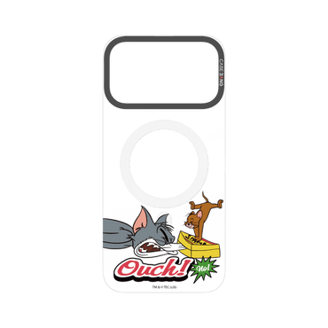 Ouch Box Trick Snap-On Phone Case